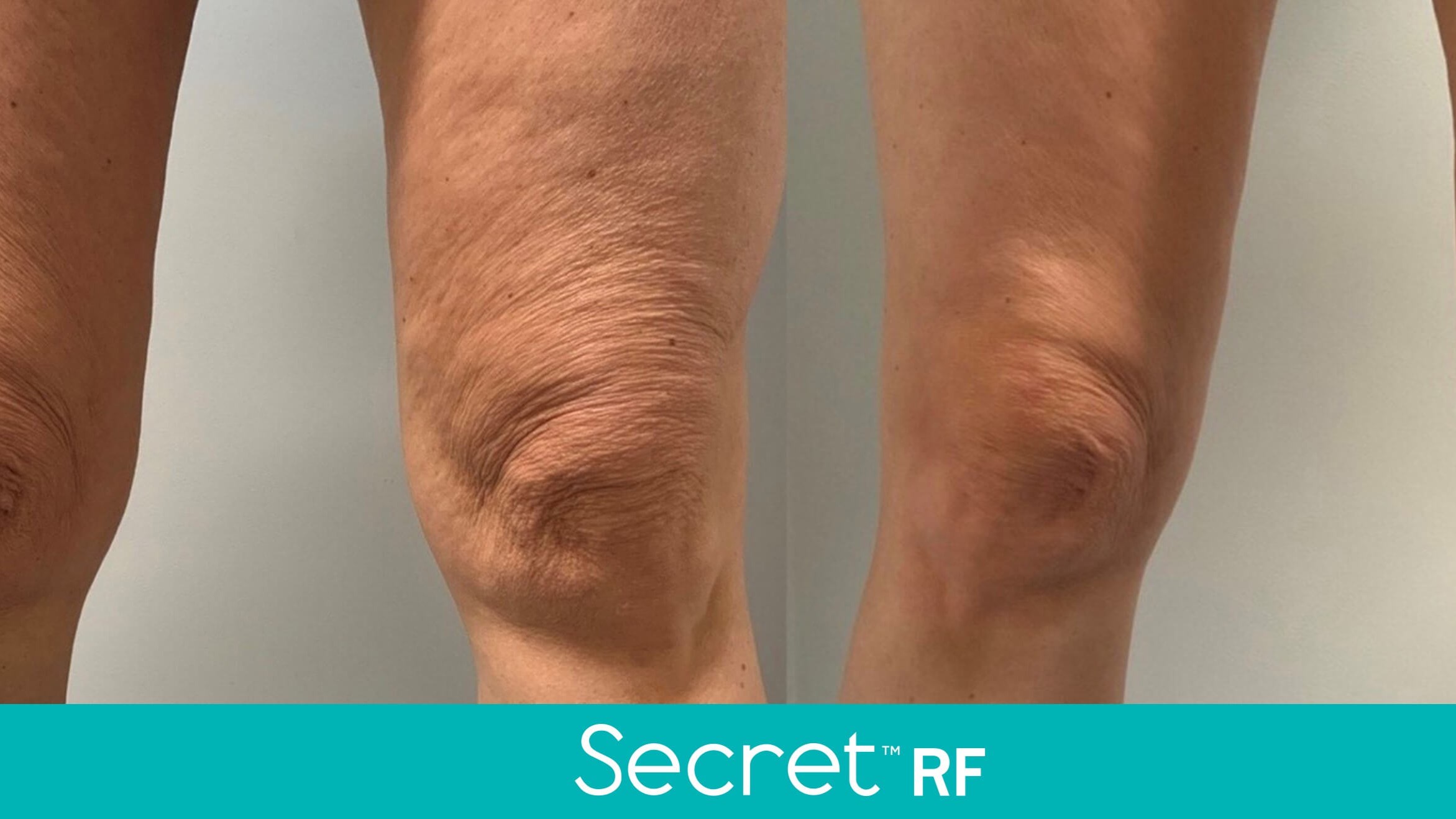 Secret RF Results!